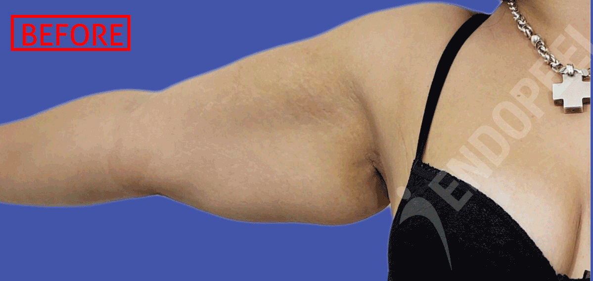arm lift gif